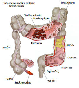 enterou3